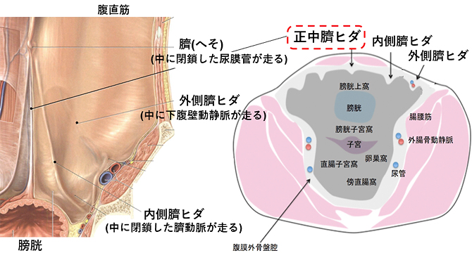 尿膜管の解剖